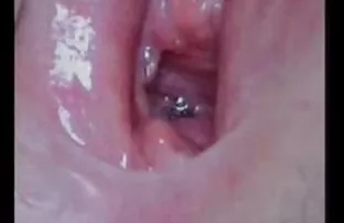 ცოლი, ალურა ჯენსონი